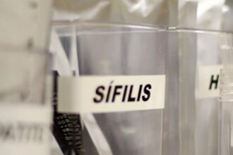centro-de-sp-tem-testagem-gratis-de-hiv,-hepatite,-siflis-e-gonorreia