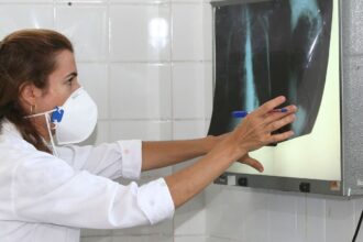 oms-recomenda-testes-de-diagnostico-rapido-para-erradicar-tuberculose