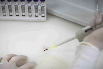 paciente-em-sp-com-suspeita-de-ebola-testa-positivo-para-meningite