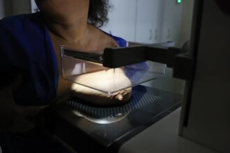 ans-defende-que-plano-cubra-mamografia-digital-sem-restricao-de-idade