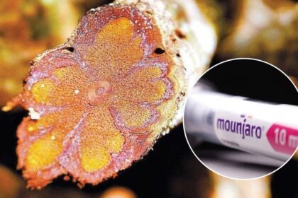 depois-de-dominar-o-emagrecimento,-dona-do-mounjaro-aposta-no-psicodelismo-da-ayahuasca-como-remedio-e-mira-lucro-de-r$-35,7-bi