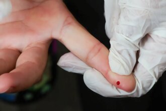 brasil-atinge-meta-de-reducao-da-transmissao-vertical-de-hepatite-b